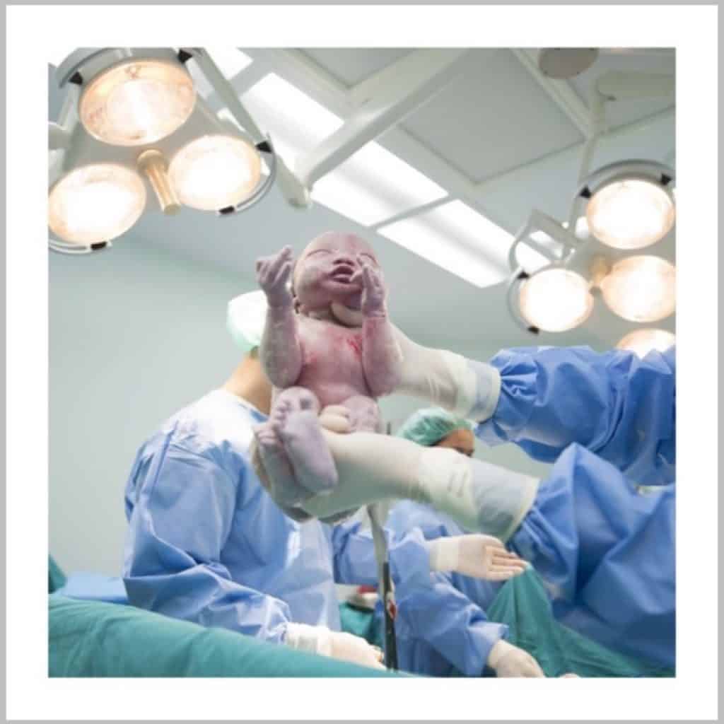 WHAT DOES A DAD OR BIRTH PARTNER DO DURING A C-SECTION? - Purely